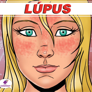 LÚPUS: VOCÊ SABE O QUE É?
