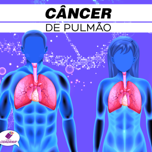 Câncer de pulmão