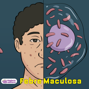 FEBRE MACULOSA