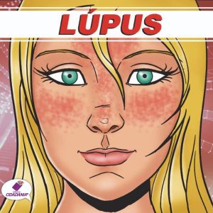 LÚPUS