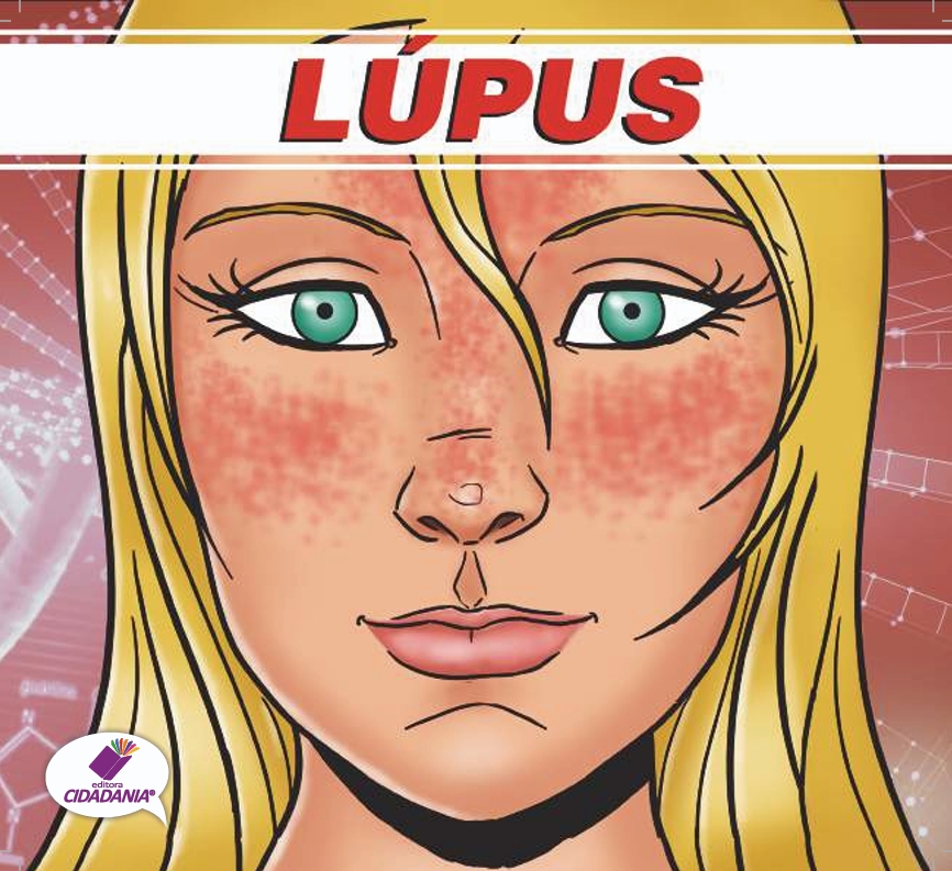 LÚPUS